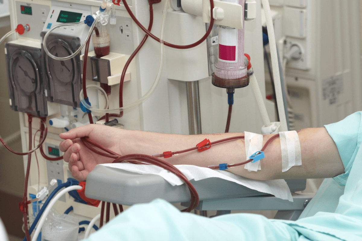 Kidney Dialysis Machine